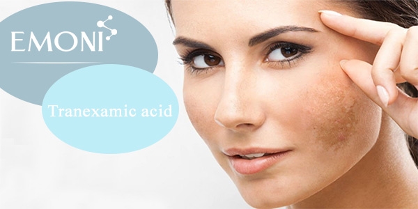 درمان لک با ترانگزامیک اسید برای اولین بار در ایران