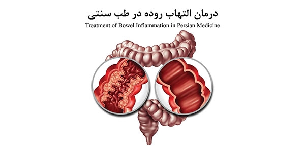 درمان التهاب روده در طب سنتی