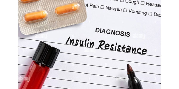معرفی 3 مکمل برای مقاومت به انسولین