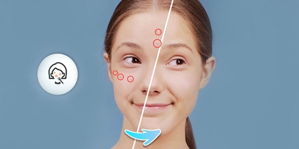 خواص و نحوه استفاده پماد زینک اکساید برای لک صورت