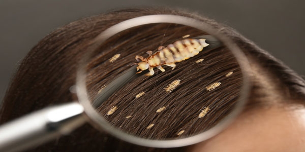 رشک مو چیست و چگونه برطرف می‌شود؟