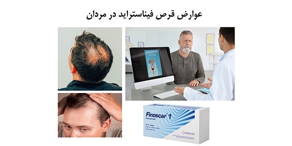 عوارض قرص فیناستراید در مردان
