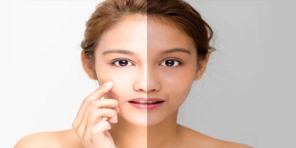 عوارض آلفا آربوتین