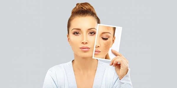 معرفی 3 کرم روشن کننده فاقد هیدروکینون