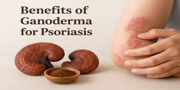 خواص گانودرما برای پسوریازیس