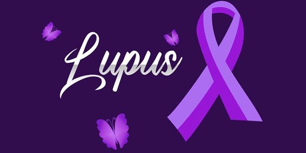 همه چیز در مورد بیماری لوپوس
