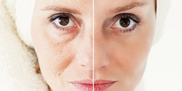 راههای مقابله با چین و چروک صورت