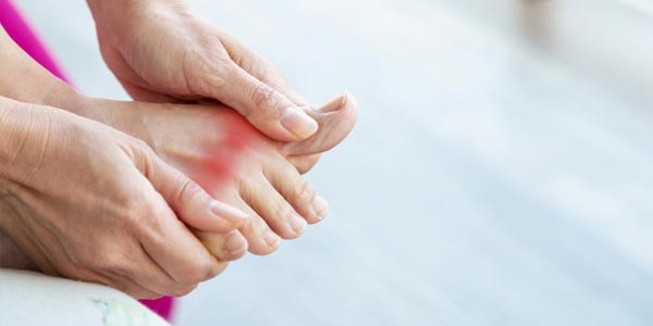 همه چیز درباره نقرس