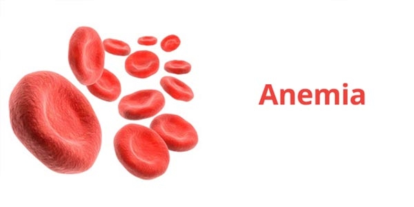 رپورتاژ- ویژگی های مکمل مناسب در درمان و پیشگیری از کم‌خونی