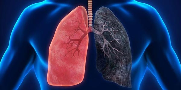 مهمترین بیماری های ریوی کدامند؟