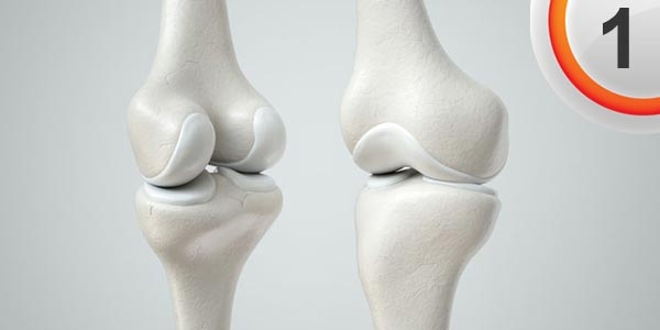 مقایسه مکمل های غضروف ساز (گلوکوزآمینی) قسمت اول