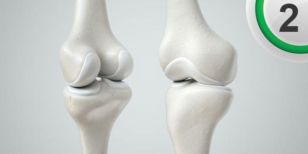 مقایسه مکمل های غضروف ساز (غیر گلوکوز آمینی) قسمت دوم