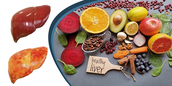 فرد مبتلا به کبد چرب چه غذاهایی باید بخورد؟