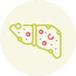 کبد چرب و صفرا آور
