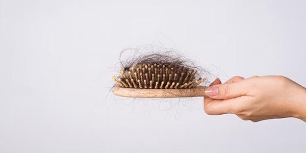 ریزش موی آندروژنیک در زنان و مردان و درمان‌های رایج