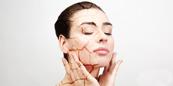 درمان سریع خشکی پوست صورت