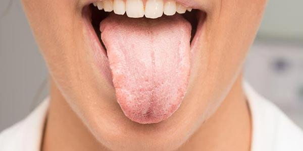 دلایل و علایم خشکی دهان و درمان آن