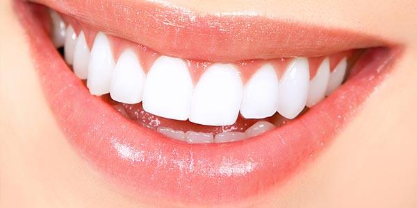 رپورتاژ- راه حلی آسان برای سفید کردن دندان ها