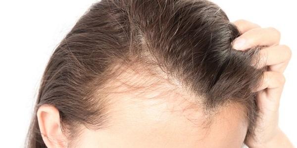 نورکرین چیست و چگونه از ریزش مو جلوگیری می کند؟